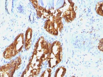 Anti-Prostate Specific Acid Phosphatase (PSAP) Monoclonal Antibody(Clone: ACPP/1338)