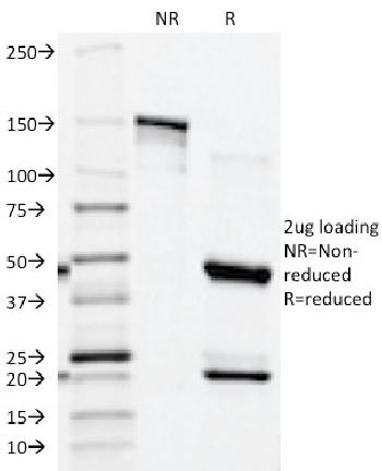 Anti-Prostate Specific Acid Phosphatase (PSAP) Monoclonal Antibody(Clone: ACPP/1339)