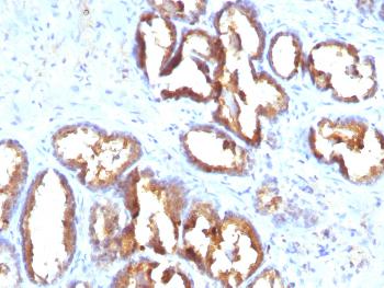 Anti-Prostate Specific Acid Phosphatase (PSAP) Monoclonal Antibody(Clone: PASE/4LJ)