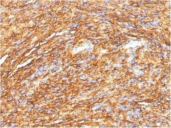 Anti-DOG-1 / TMEM16A (Gastrointestinal Stromal Tumor Marker) Monoclonal Antibody(Clone: DG1/1484)