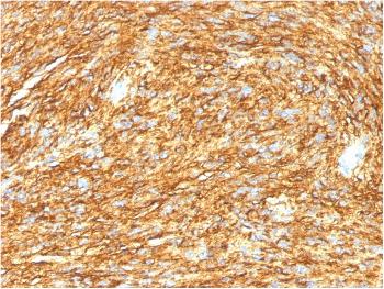 Anti-DOG-1 / TMEM16A (Gastrointestinal Stromal Tumor Marker) Monoclonal Antibody(Clone: DG1/1485)