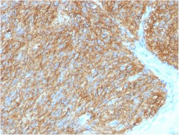 Anti-DOG-1 / TMEM16A (Gastrointestinal Stromal Tumor Marker) Monoclonal Antibody(Clone: DG1/1486)