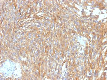 Anti-DOG-1 / TMEM16A (Gastrointestinal Stromal Tumor Marker) Monoclonal Antibody(Clone: DG1/2564R)