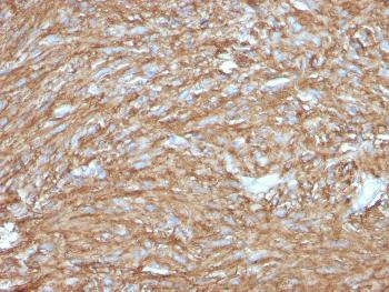 Anti-DOG-1 / TMEM16A (Gastrointestinal Stromal Tumor Marker) Monoclonal Antibody(Clone: DG1/2831R)