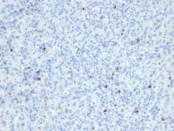 Anti-Perforin (Pore Forming Protein) (Apoptosis Marker) Monoclonal Antibody(Clone: SPM434)