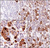 Monoclonal Antibody to ACTH (Clone: AH26)