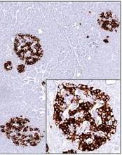 Monoclonal Antibody to Insulin (Clone: 2D11-H5)