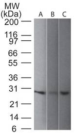 Monoclonal Antibody to UchL1 (Clone: 31A3)