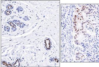 Monoclonal Antibody to Progesterone Receptor (Clone: C-80)(Discontinued)