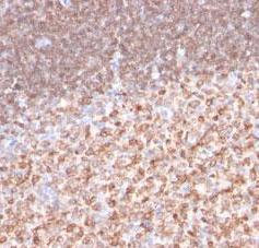 Monoclonal Antibody to CD74w (Clone: LN-2)