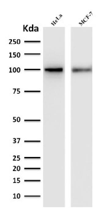 Anti-ENAH / MENA (Actin Regulator) Monoclonal Antibody(Clone: ENAH/1988)