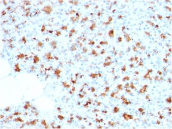 Anti-BARX1 (Prognostic Biomarker in Hepatocellular Carcinoma) Monoclonal Antibody(Clone: BARX1/2759)