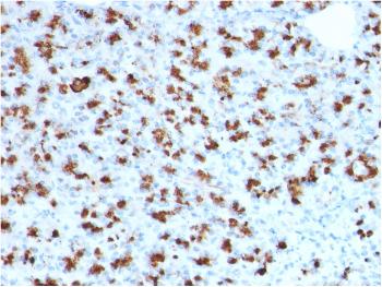 Anti-BARX1 (Prognostic Biomarker in Hepatocellular Carcinoma) Monoclonal Antibody(Clone: BARX1/2760)