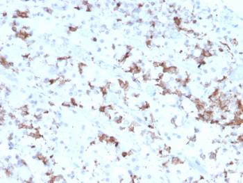 Anti-Prolactin (Pituitary Tumor Marker) Monoclonal Antibody(Clone: PRL/2641)