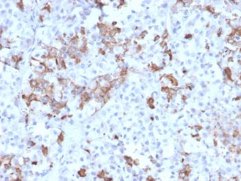 Anti-Prolactin (Pituitary Tumor Marker) Monoclonal Antibody(Clone: PRL/2642)