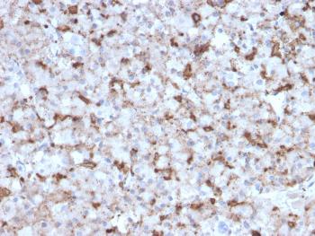 Anti-Prolactin (Pituitary Tumor Marker) Monoclonal Antibody(Clone: PRL/2643)