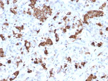 Anti-Prolactin (Pituitary Tumor Marker) Monoclonal Antibody(Clone: PRL/2644)