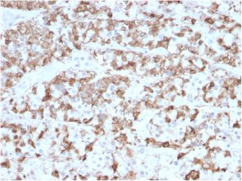 Anti-Prolactin (Pituitary Tumor Marker) Monoclonal Antibody(Clone: PRL/2910)