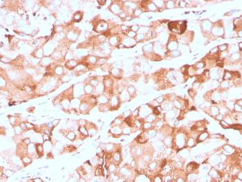 Anti-Prolactin Receptor (hPRL Receptor) Monoclonal Antibody(Clone: rPRLR/742)