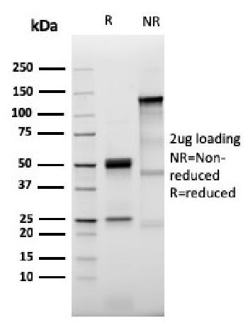 Anti-Prolactin Receptor (hPRL Receptor) Monoclonal Antibody(Clone: PRLR/3785R)