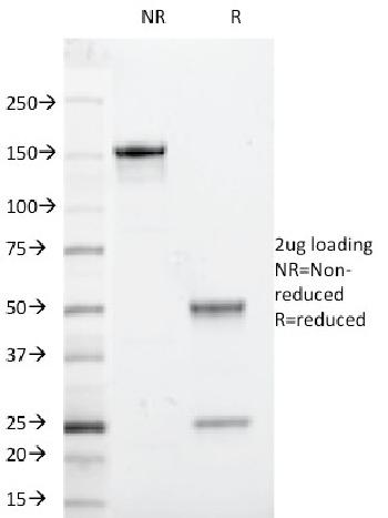 Anti-Beta-2 Microglobulin (Renal Failure & Tumor Marker) Monoclonal Antibody(Clone: 246-E9.E7; same as HLA.ABC.m2)