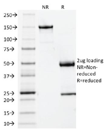 Anti-Beta-2 Microglobulin (Renal Failure & Tumor Marker) Monoclonal Antibody(Clone: BBM.1)