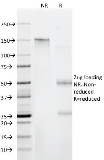 Anti-Beta-2 Microglobulin (Renal Failure & Tumor Marker) Monoclonal Antibody(Clone: C21.48A1)