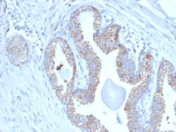 Anti-PMEPA1 / TMEPAI (Tumor Suppressor Oncoprotein) Monoclonal Antibody(Clone: PMEPA1/2697)