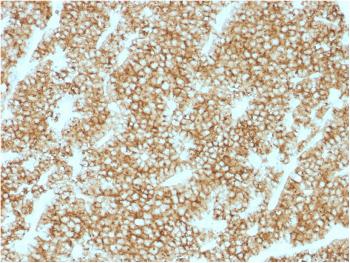 Anti-Parathyroid Hormone (PTH) (N-Terminal) Monoclonal Antibody(Clone: PTH/1717R)