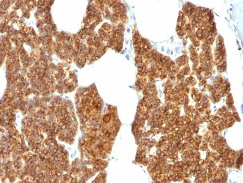 Anti-Parathyroid Hormone (PTH) (N-Terminal) Polyclonal Antibody