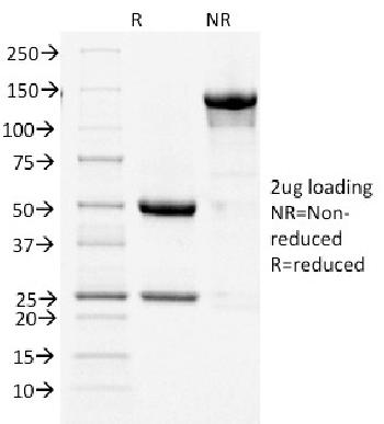 Anti-Cycloxygenase-2 (COX-2) Monoclonal Antibody(Clone: COX2/1941)