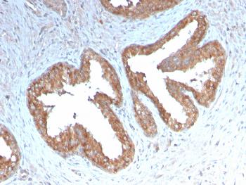 Anti-Cycloxygenase-2 (COX-2) Monoclonal Antibody(Clone: COX2/3232R)