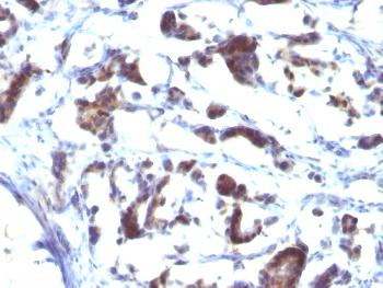 Anti-ZFYVE28 (Zinc Finger FYVE-type containing 28) Monoclonal Antibody(Clone: LST2/2426)