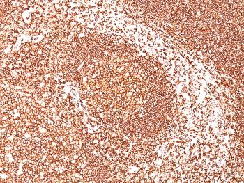 Anti-CD45 / LCA (B-Cell Marker) Monoclonal Antibody(Clone: PTPRC/1461)