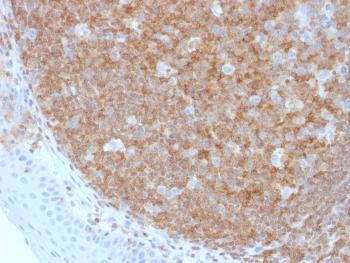 Anti-CD45 / LCA (B-Cell Marker) Monoclonal Antibody(Clone: F10-89-4)