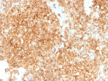 Anti-CD45 / LCA (Leucocyte Marker) Monoclonal Antibody(Clone: PTPRC/1147 + PTPRC/1460)