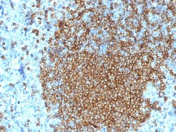 Anti-CD45RA (Leukocyte Marker) Monoclonal Antibody(Clone: K4B5)