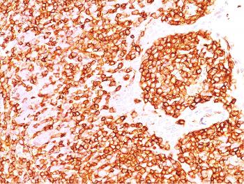 Anti-CD45 / LCA (B-Cell Marker) Monoclonal Antibody(Clone: rPTPRC/1460)