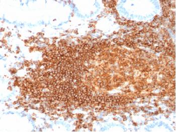 Anti-CD45RB (B-Cell Marker) Monoclonal Antibody(Clone: rPTPRC/1132)