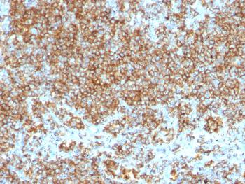 Anti-CD45 / LCA (Leucocyte Marker) Monoclonal Antibody(Clone: SPM569 + SPM570)-FITC