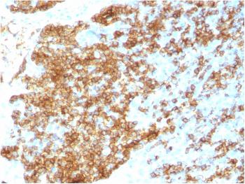 Anti-CD45RB (B-Cell Marker) Monoclonal Antibody(Clone: PTPRC/1783R)