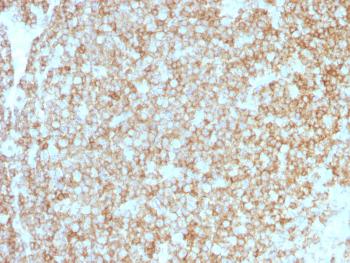 Anti-CD45 / LCA (Leucocyte Marker) Monoclonal Antibody(Clone: PTPRC/1783R + PTPRC/1975R)