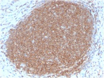 Anti-CD45RB (B-Cell Marker) Monoclonal Antibody(Clone: PTPRC/2877R)