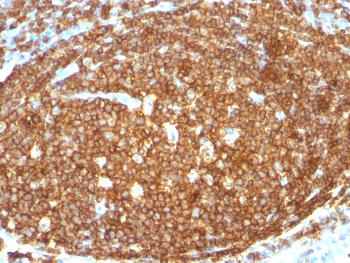 Anti-CD45RB (B-Cell Marker) Polyclonal Antibody