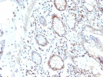 Anti-RAD51 (Prognostic and Response to Chemotherapy Marker) Monoclonal Antibody(Clone: RAD51/2702)