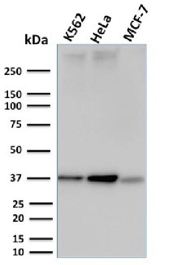 Anti-RAD51 (Prognostic and Response to Chemotherapy Marker) Monoclonal Antibody(Clone: RAD51/2753)