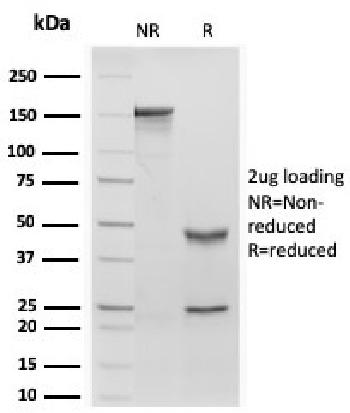 Anti-Retinol Binding Protein-1 (RBP1) Monoclonal Antibody(Clone: rRBP1/872)