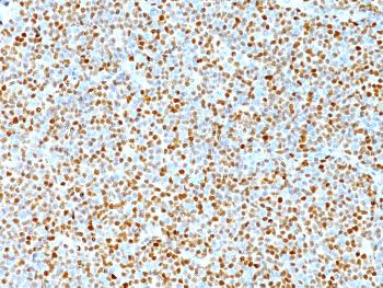 Anti-Cyclin D1 (G1-Cyclin & Mantle Cell Marker) Monoclonal Antibody(Clone: DCS-6)