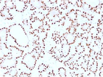 Anti-Cyclin D1 (G1-Cyclin & Mantle Cell Lymphoma Marker) Monoclonal Antibody(Clone: CCND1/2593)