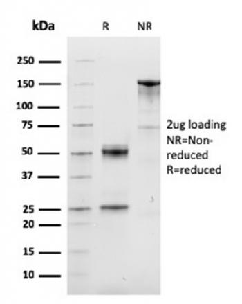 Anti-Cyclin D1 (G1-Cyclin & Mantle Cell Lymphoma Marker) Monoclonal Antibody(Clone: CCND1/3548)